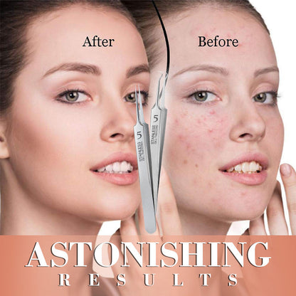 🔥 Extractor de Acero Inoxidable de Puntos Negro